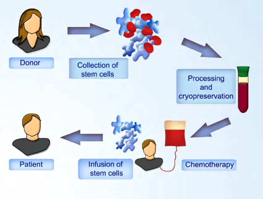 transplant de celule stem
