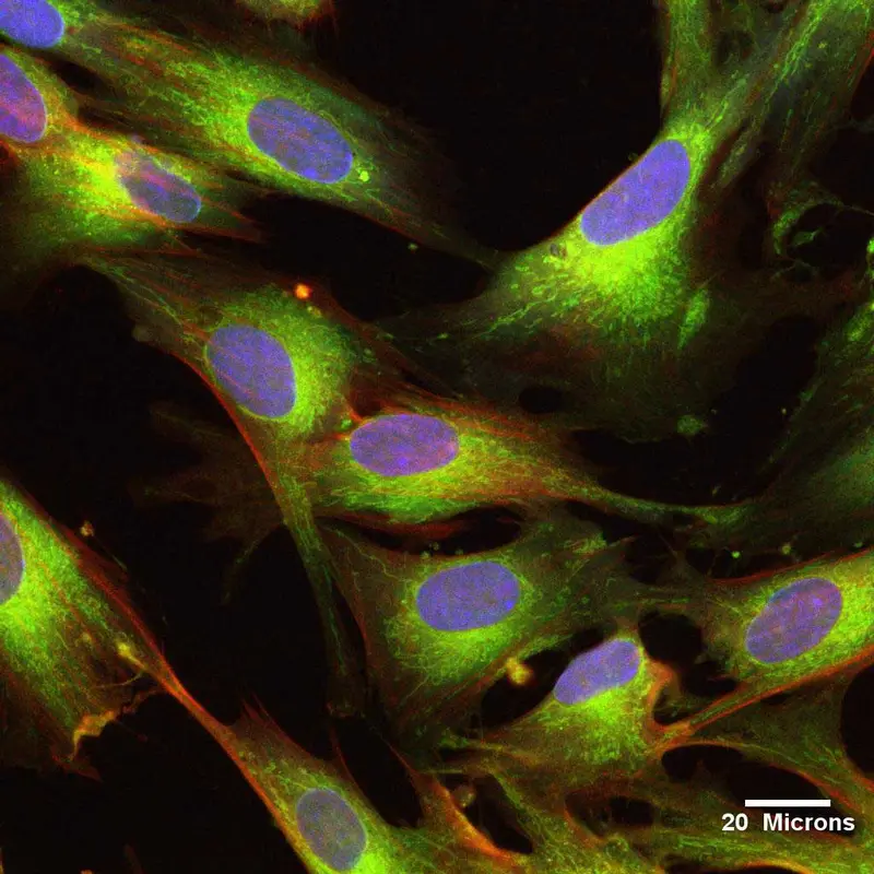 Celule stem UCMSC