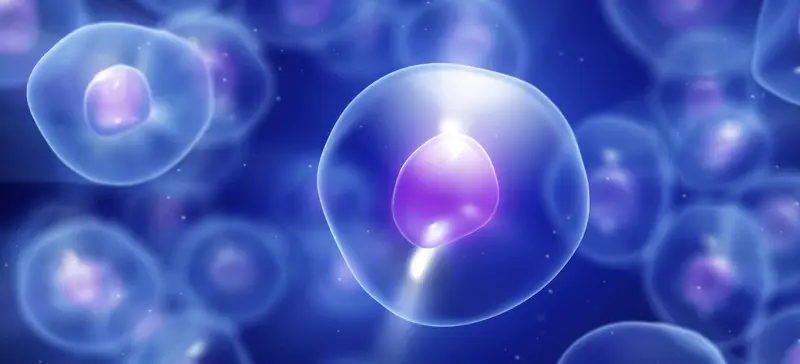 Tratamentul cu celule stem extras din sangele cordonului ombilical pentru Leziunile cerebrale