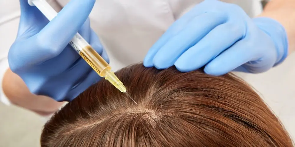 injectarea celulelor stem în scalp.